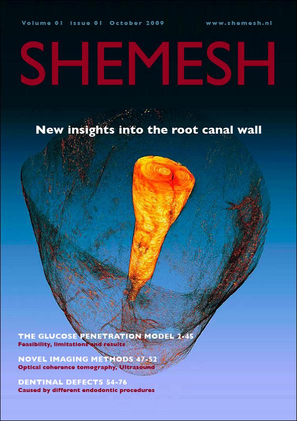 Shemesh New insights into the root canal wall